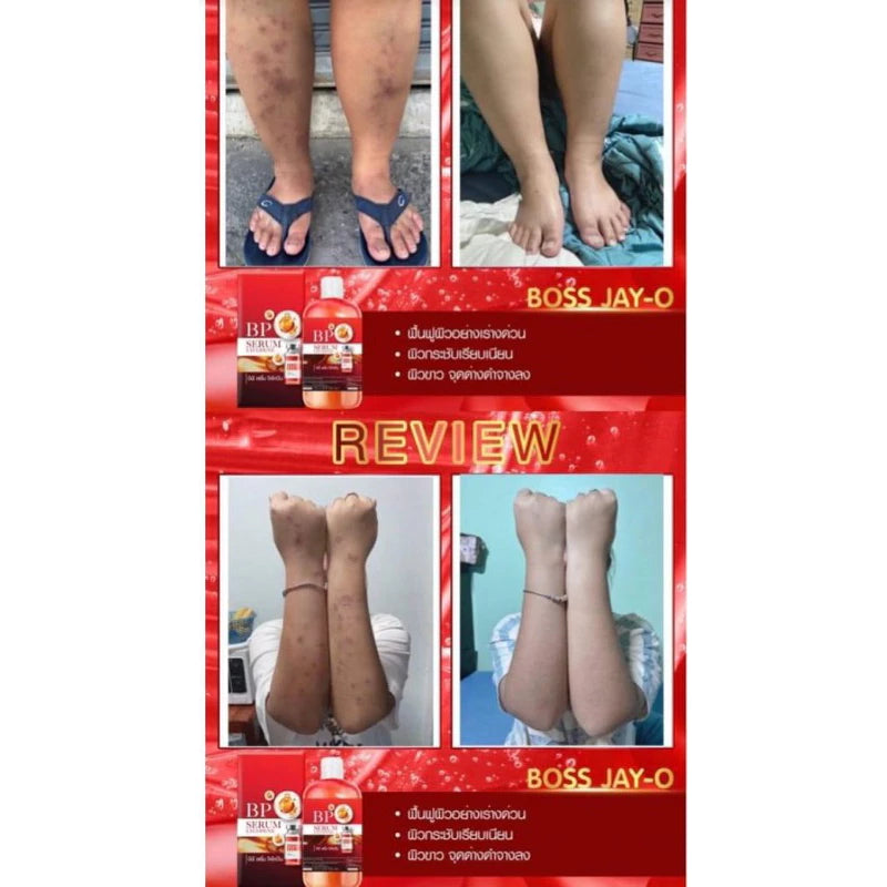 سيروم بي بي لتبييض البشرة بالليكوبين من تايلاند الأصلي 100%